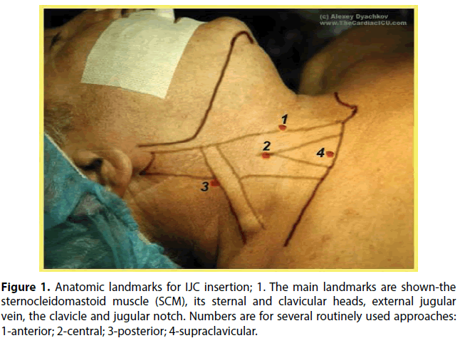interventional-nephrology-Anatomic-landmarks