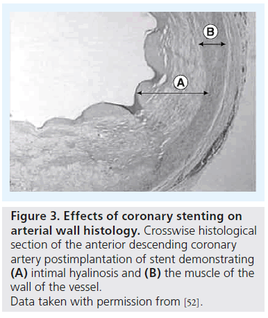 neuropsychiatry-coronary-histological-Data