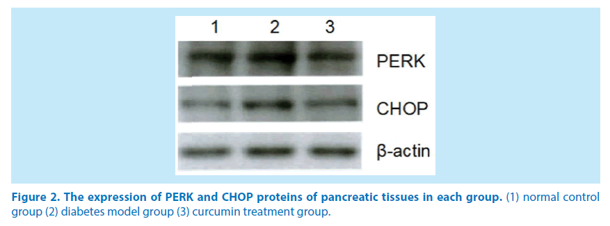 pharmaceutical-bioprocessing-CHOP-proteins