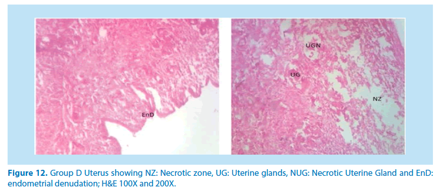 pharmaceutical-bioprocessing-endometrial-denudation