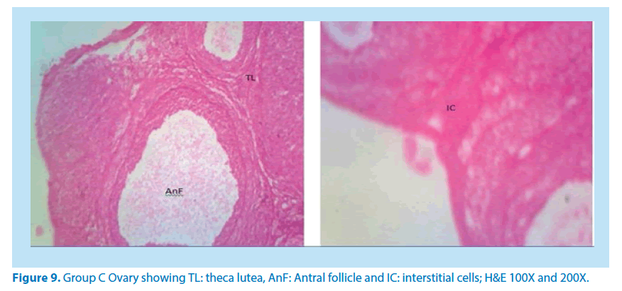 pharmaceutical-bioprocessing-interstitial-cells