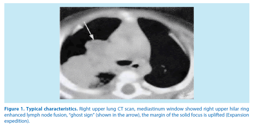 pharmaceutical-bioprocessing-mediastinum-window