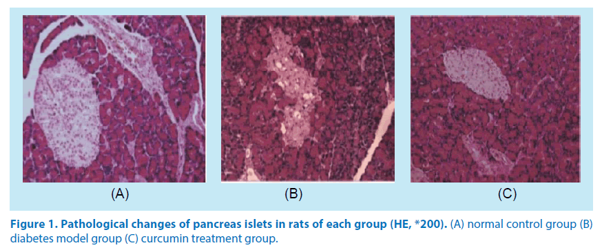 pharmaceutical-bioprocessing-pancreas-islets