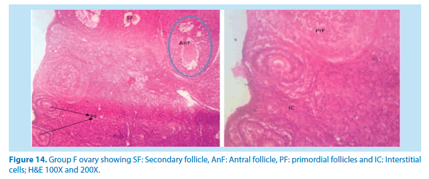 pharmaceutical-bioprocessing-primordial-follicles