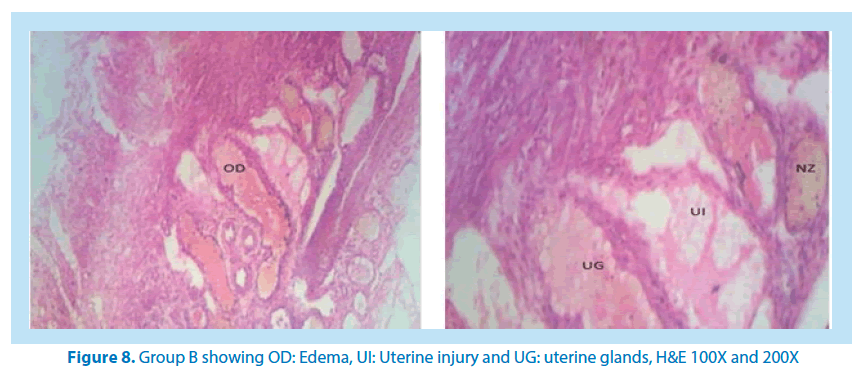 pharmaceutical-bioprocessing-uterine-glands