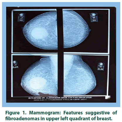 research-on-chronic-diseases-Mammogram