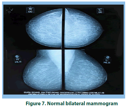 research-on-chronic-diseases-bilateral-mammogram